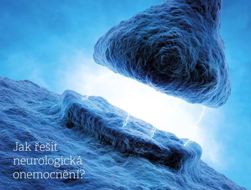Jak řešit neurologická onemocnění?